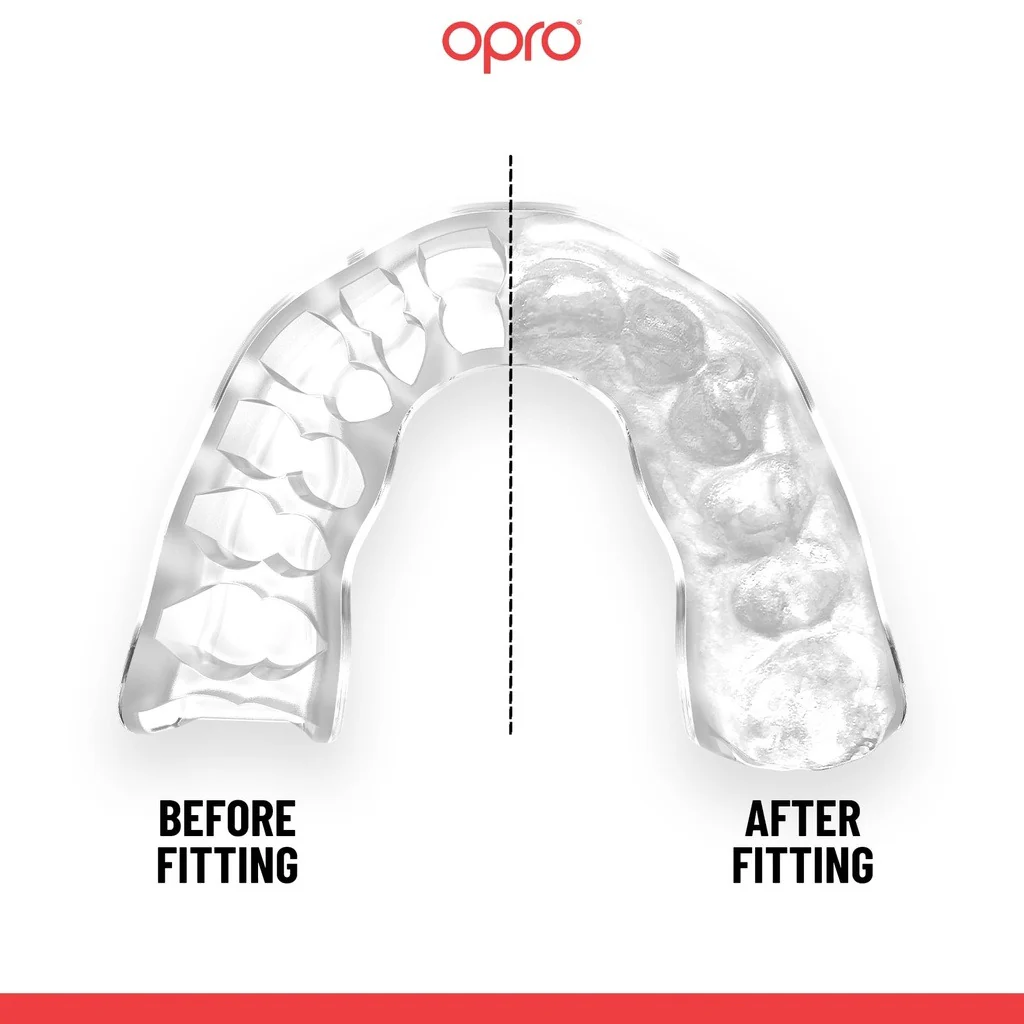 Opro Instant Custom Self Fit Mouthguard - Image 3